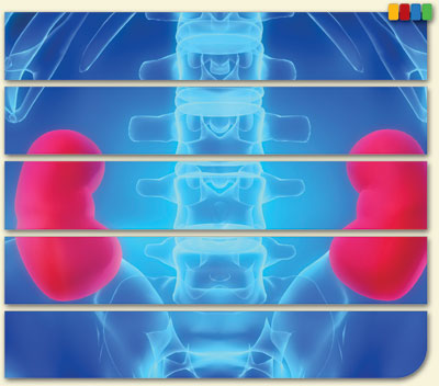 Module 1—Kidneys: How They Work, How They Fail, What You Can Do