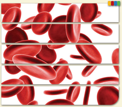 Module 6—Anemia and Kidney Disease