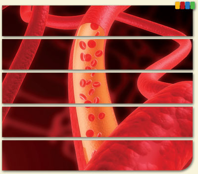 Module 8—Vascular Access: A Lifeline for Dialysis